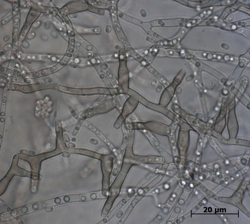 chalara-fraxinea-microscope