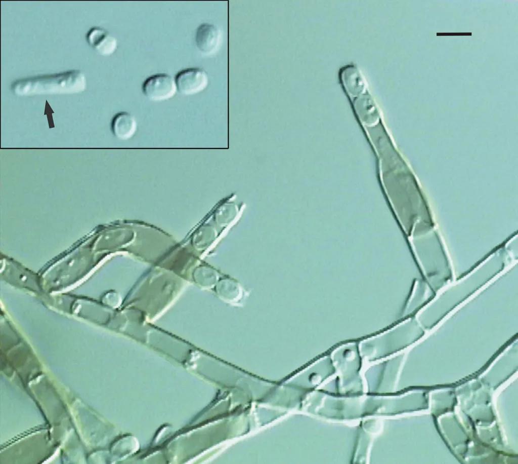 chalara-fraxinea-microscope-2